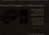 Computed Tomography of The Head and Spine : A Photogrphic Color Atlas  of CT,Gross,And Microcopic Anatomy
