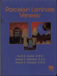 Image of Porcelain Laminate Veneers
