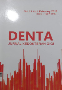 Denta (Jurnal Kedokteran Gigi) Vol. 13 No.1 Februari 2019