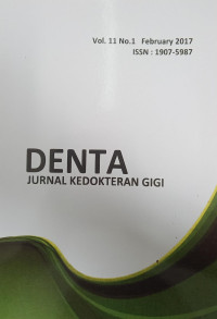 Denta (Jurnal Kedokteran Giigi) Vol. 11 No.1 Februari 2017