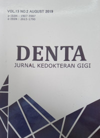 Denta (Jurnal Kedokteran Giigi) Vol. 13 No.2 Agustus 2019