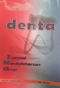 Denta (Jurnal Kedokteran Giigi) Vol. 9  No.2 Agustus 2015