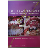 Gigi Tumpang ( Konsep dan filosofi baru rehabilitasi oral)