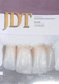 Journal Dental Technology (JDT), Vol 39 No.5 ( May)2022