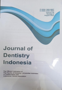 Journal of Dentistry Indonesia Vol. 29 No.2  Agustus Tahun 2022
