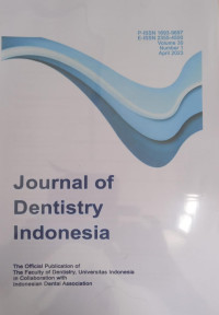 Image of Journal of Dentistry Indonesia Vol. 30 No.1  April Tahun 2023