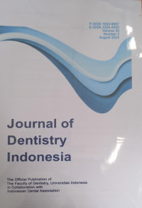 Journal of Dentistry Indonesia Vol. 30 No.2  Agustus Tahun 2023