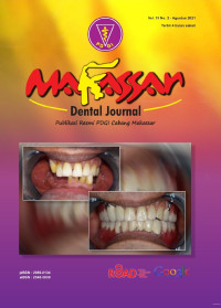 Makasar Dental Journal Vol.10 No.2 2021
