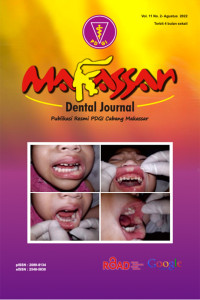 Makasar Dental Journal Vol.11 No.2 2022