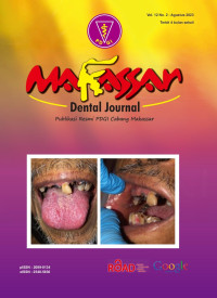 Makasar Dental Journal Vol.12 No.2 2023