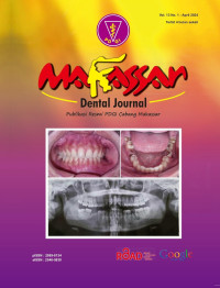 Makasar Dental Journal Vol. 13 No. 1 (2024)