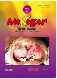 Makasar Dental Journal Vol.9 No.2 (2020)