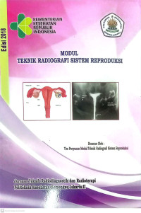 Modul Teknik Radioterapi Sistem Reproduksi