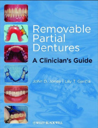 Removable partial dentures : a clinician's guide