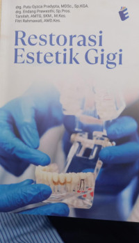 Restorasi Estetika Gigi