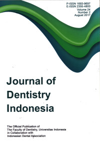 Image of Journal of Dentistry Indonesia Vol. 24 No.2 Tahun 2017